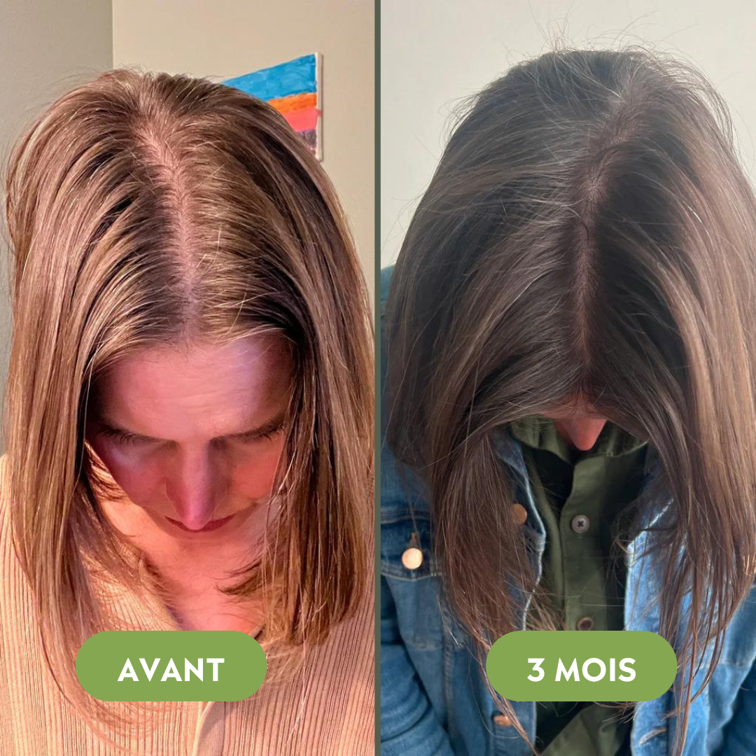 Sérum de croissance pour cheveux (60ml)