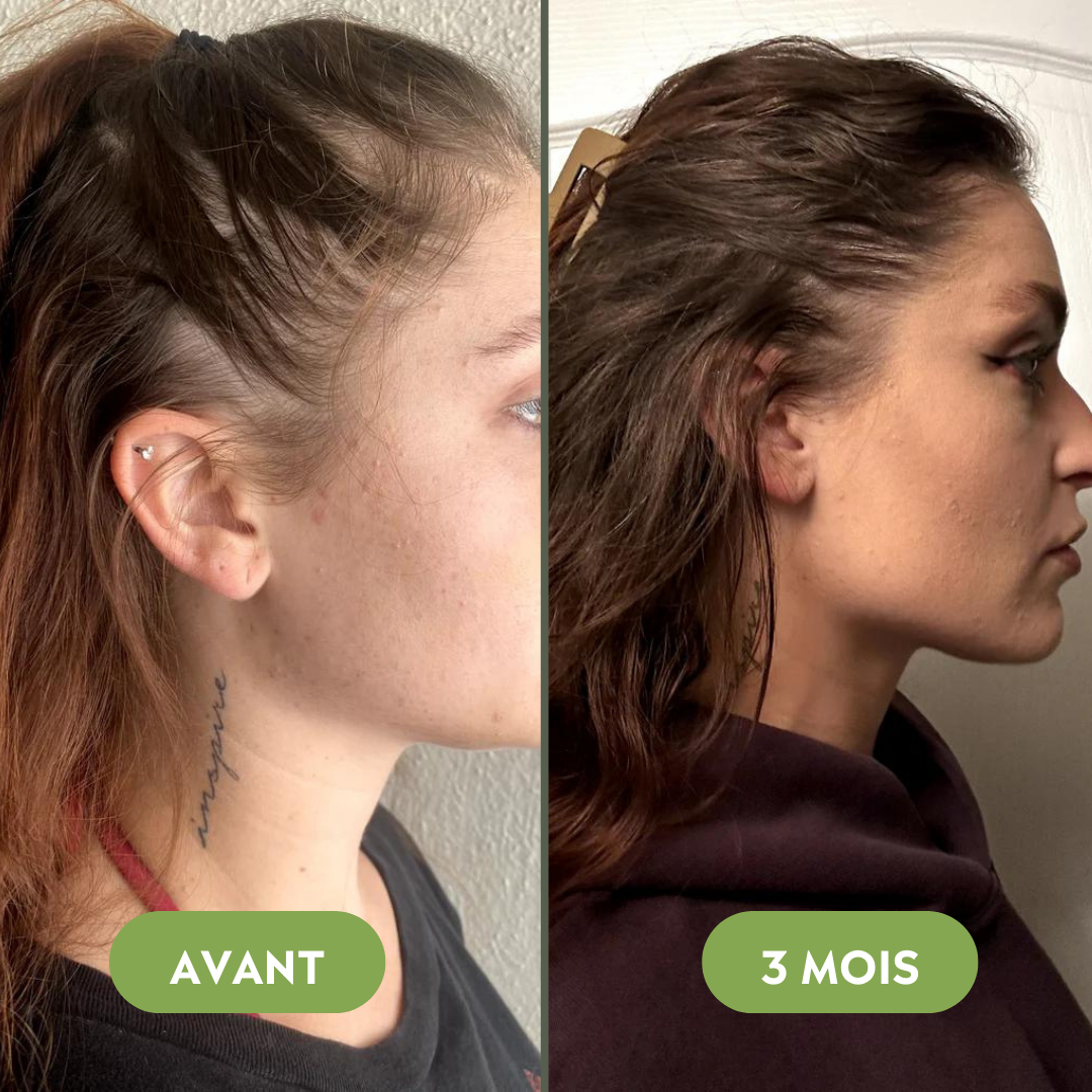 Sérum de croissance pour cheveux (60ml)