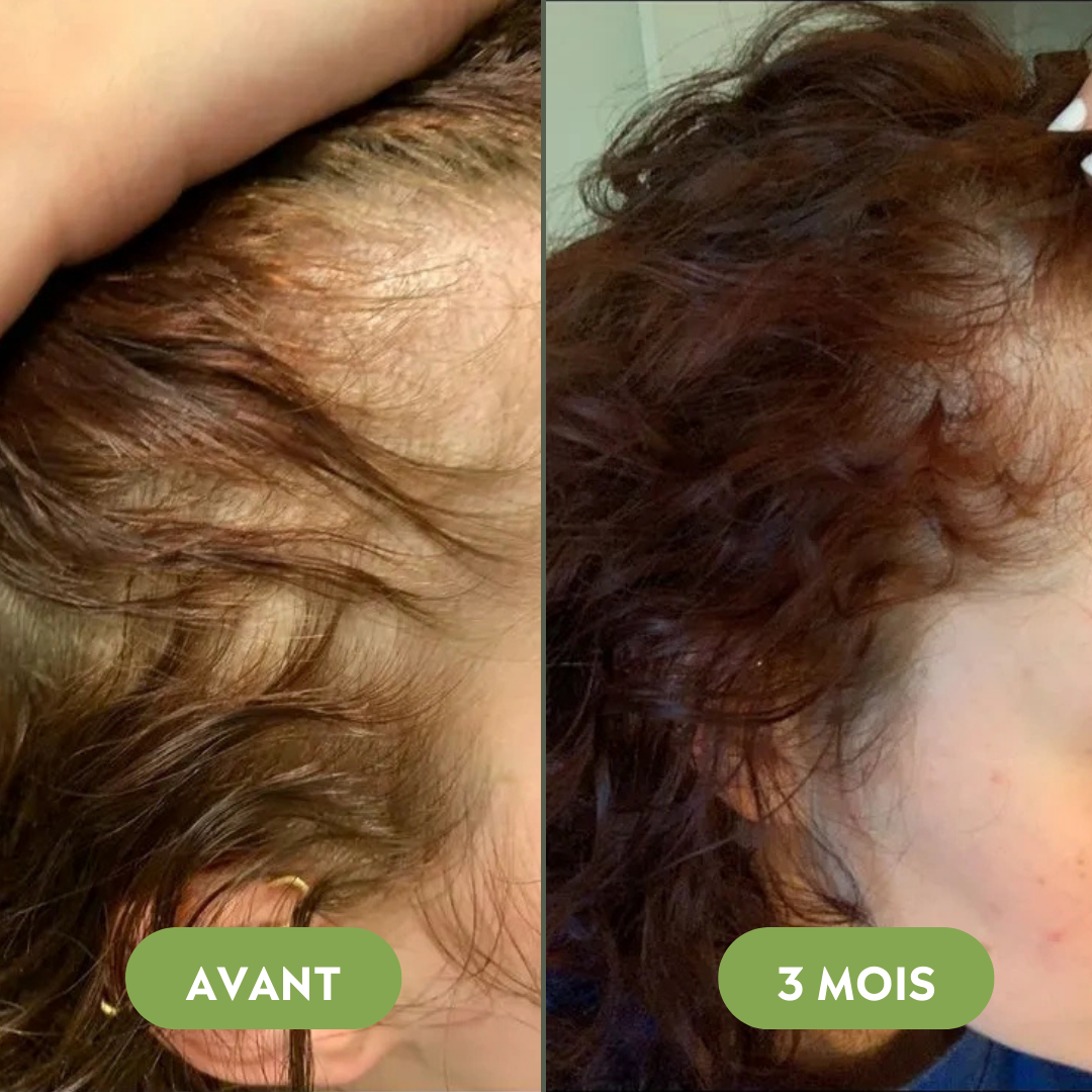 Sérum de croissance pour cheveux (60ml)