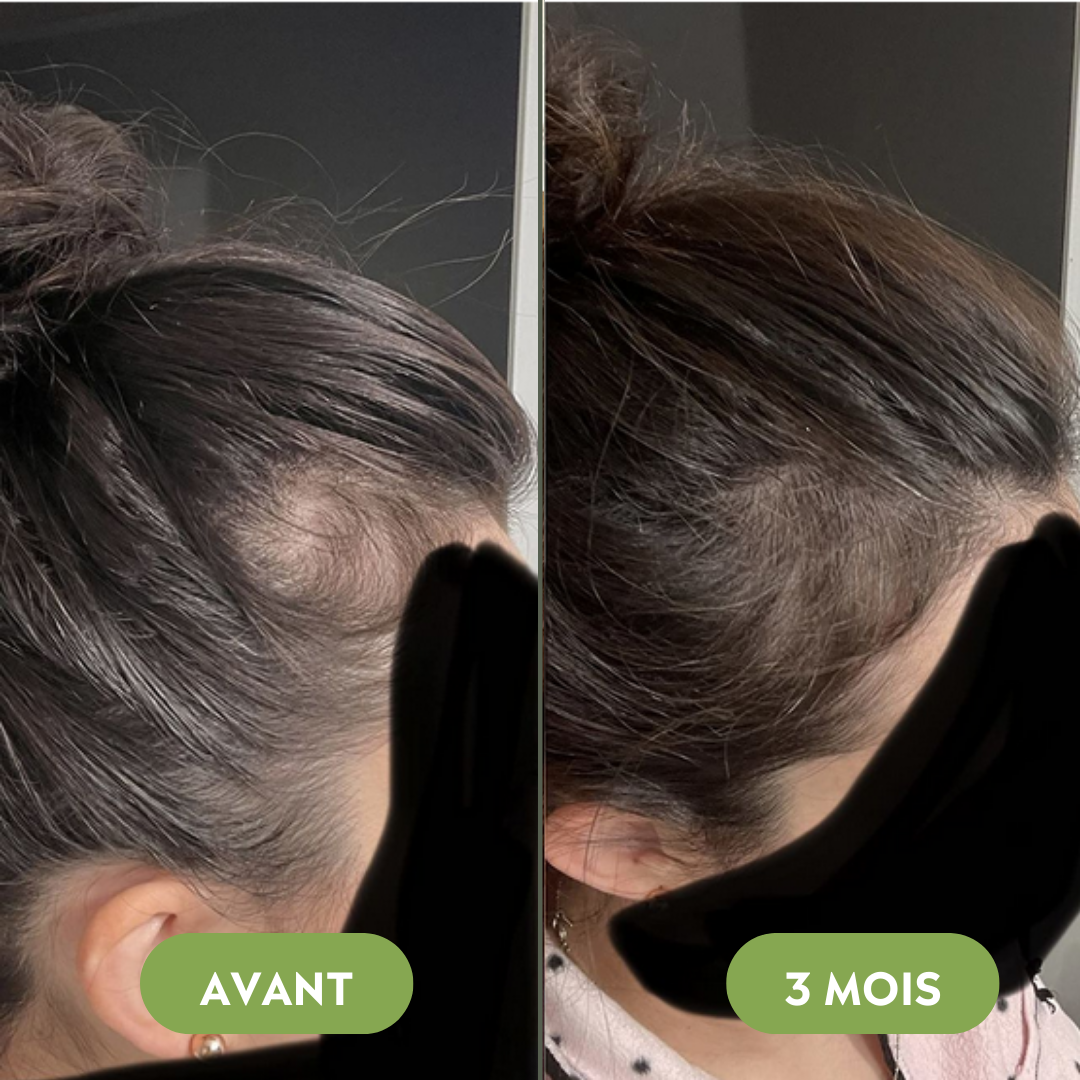 Sérum de croissance pour cheveux (60ml)