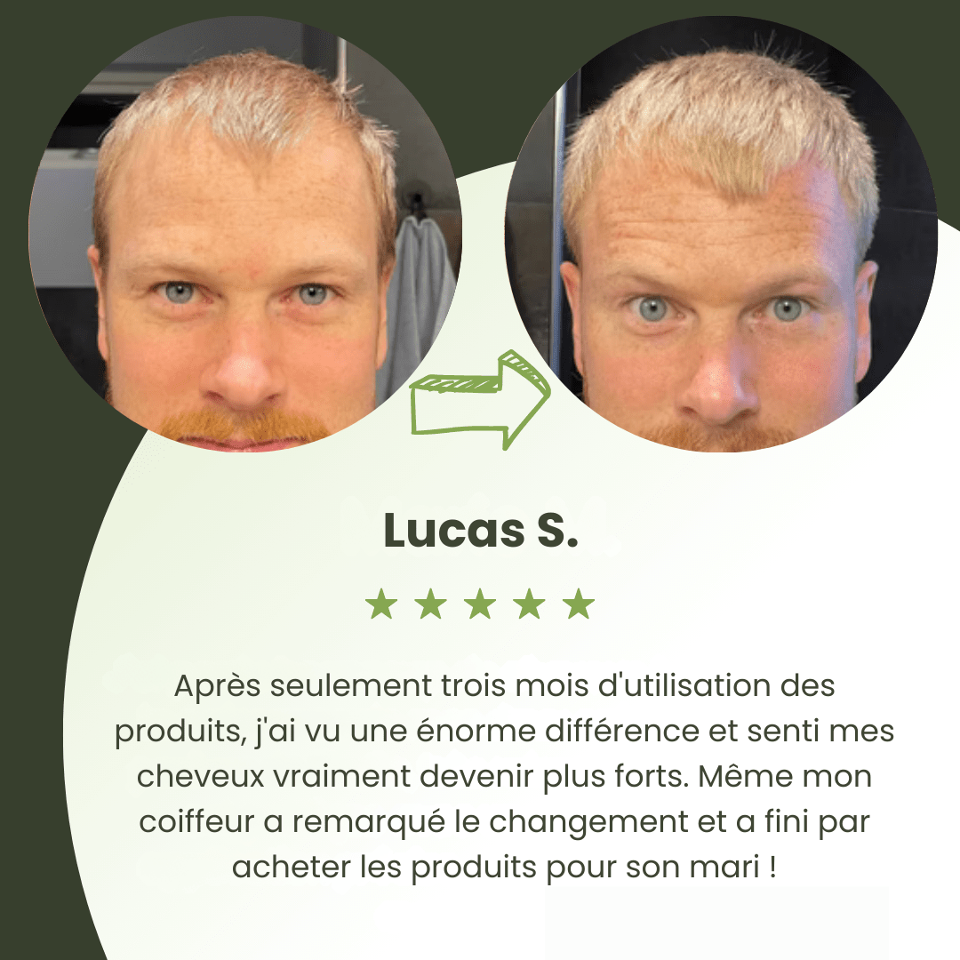 Sérum de Croissance Capillaire pour Hommes