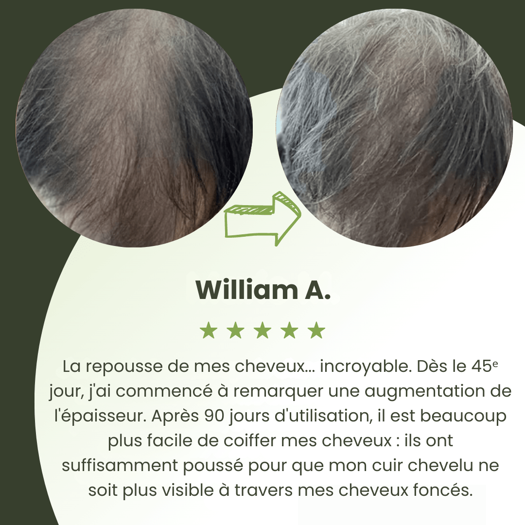 Sérum de Croissance Capillaire pour Hommes