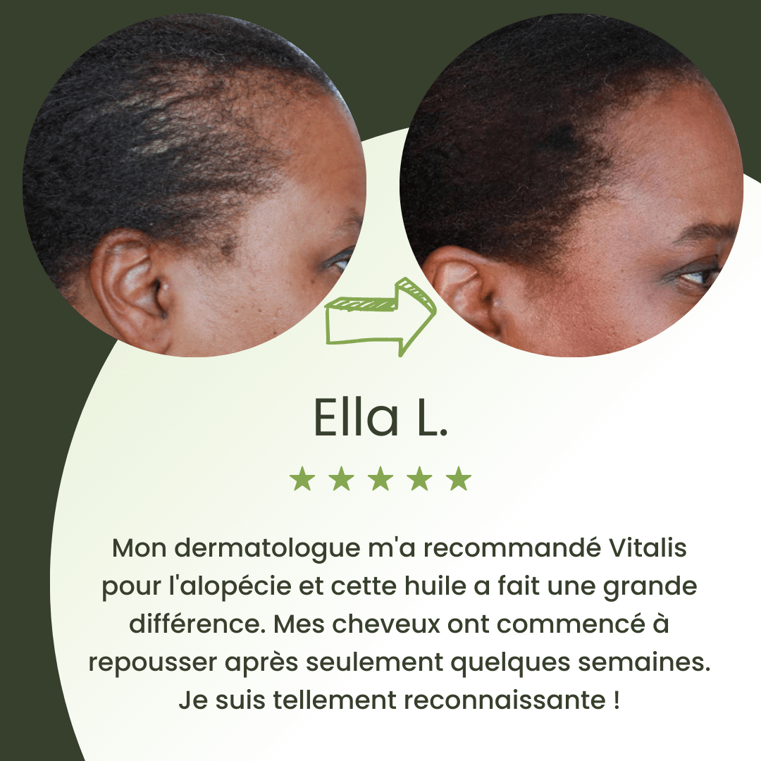 Sérum de croissance pour cheveux (60ml)