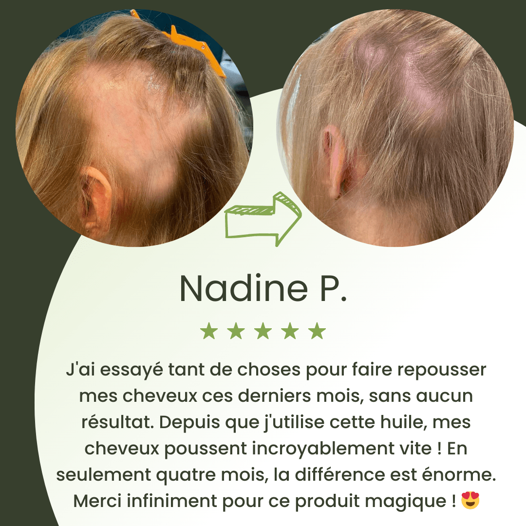 Sérum de croissance pour cheveux (60ml)