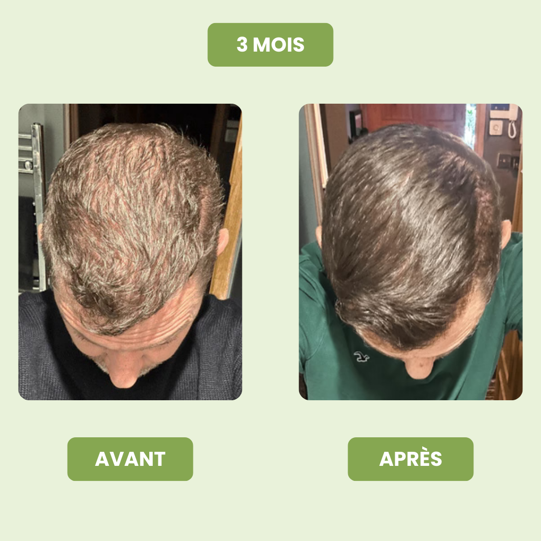 Sérum de Croissance Capillaire pour Hommes