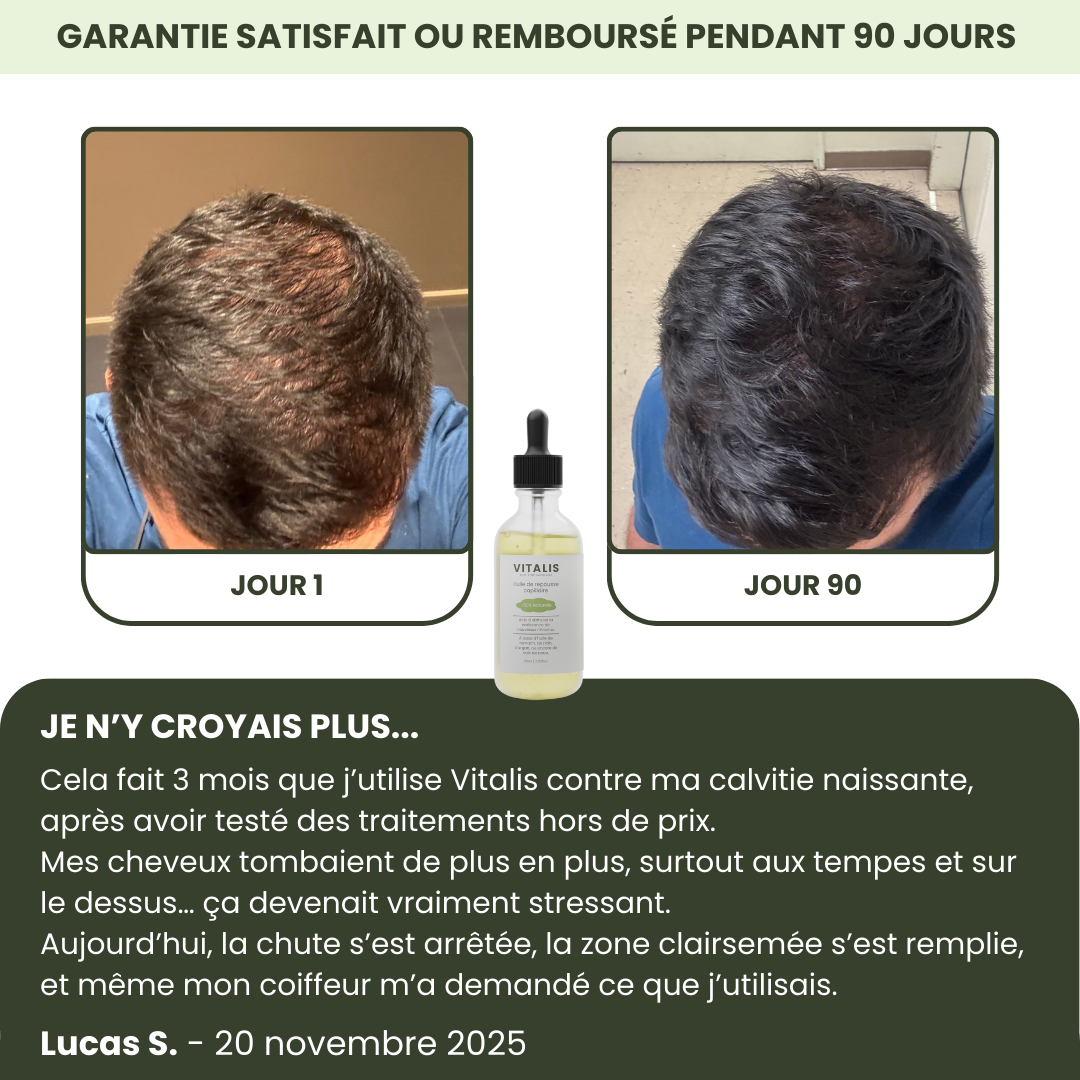 Sérum de Croissance Capillaire pour Hommes