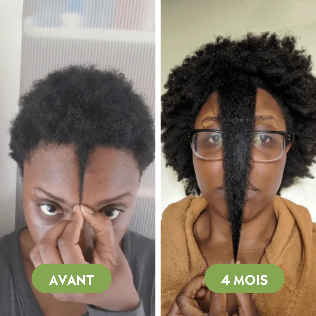 Huile de croissance pour cheveux (100% Naturelle)