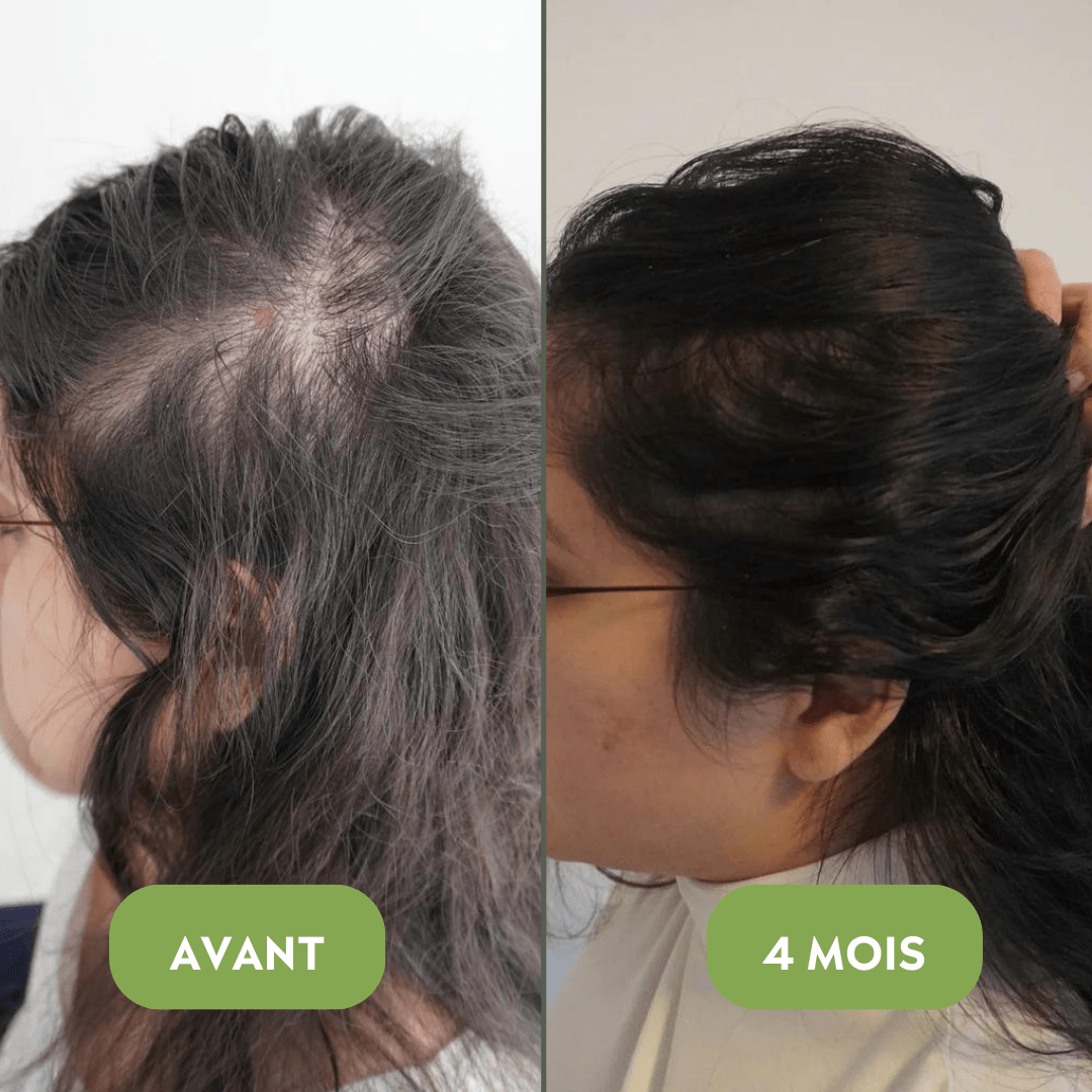 Huile de croissance pour cheveux (100% naturelle)