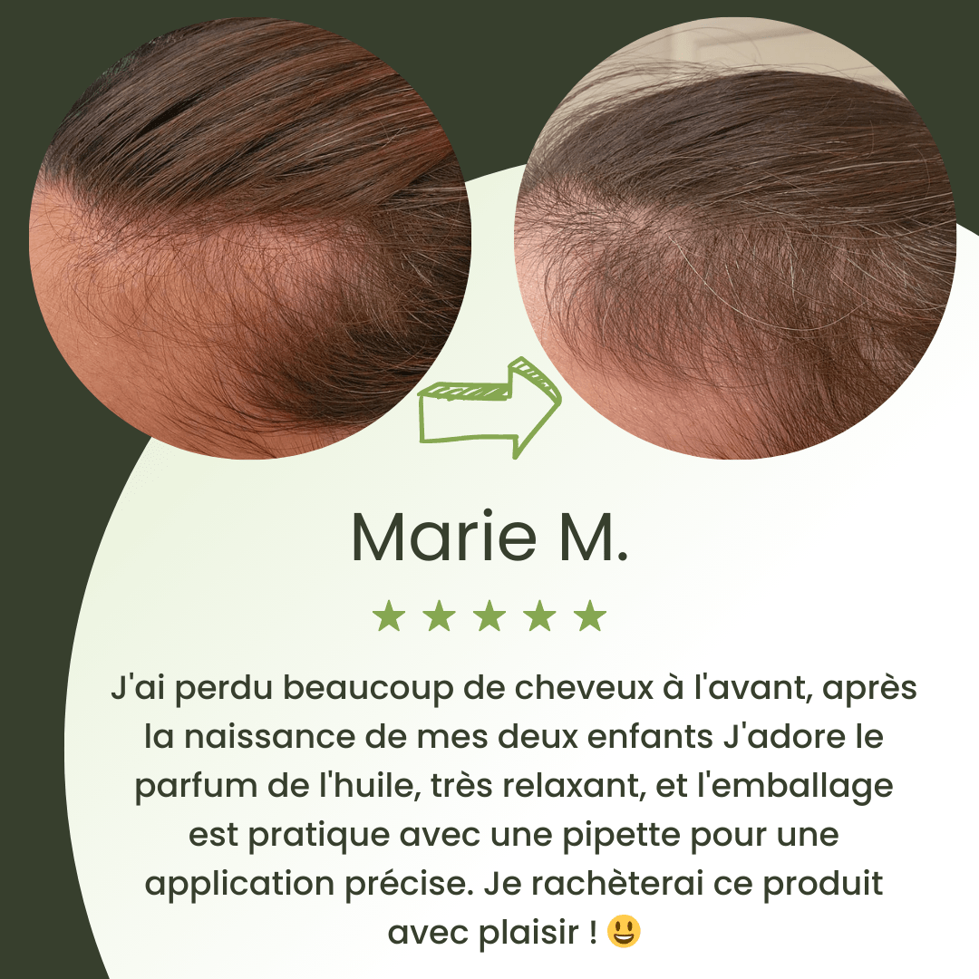 Huile de croissance pour cheveux (100% naturelle)