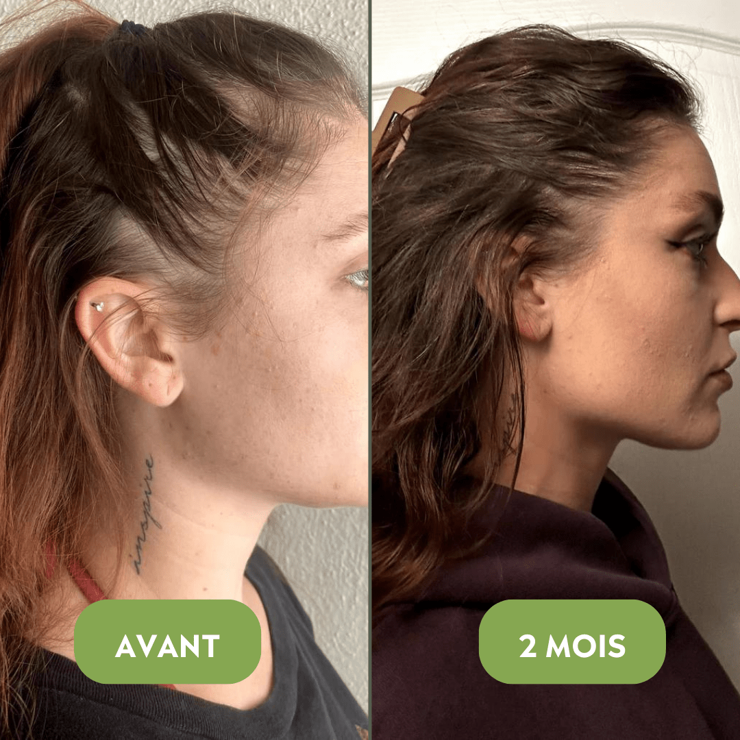 Huile de croissance pour cheveux (100% naturelle)